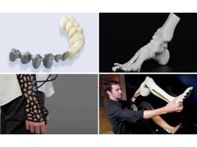 醫(yī)療/假肢 醫(yī)療/假肢